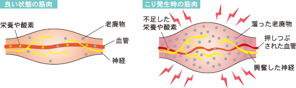 筋肉の状態