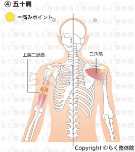 五十肩