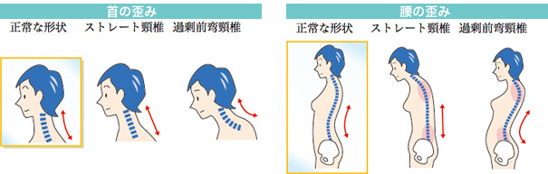 骨格調整