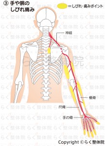 手や腕のしびれ