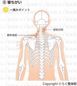 寝ちがい