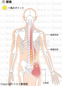 腰痛