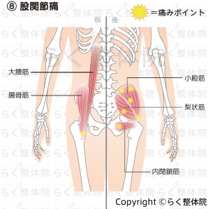 股関節痛