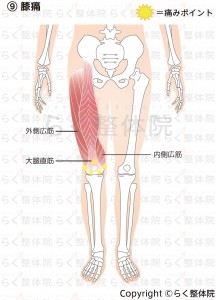 膝痛